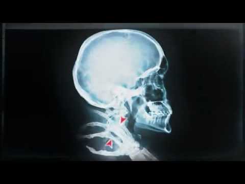 See video
