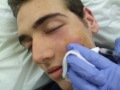 The Boil/Cyst/Whatever