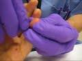 fish hook fixin\ fish hook fixin\
