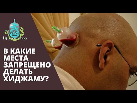 Плетение из резинок все собачки Плетение из резинок все собачки