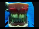 ODONTOLOGIA PREVENTIVA ODONTOLOGIA PREVENTIVA