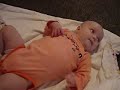 Infantile spasms Infantile spasms
