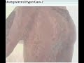coroa se mostrando na webcam