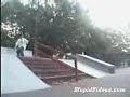 ouch2 !!