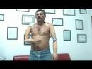 Edimar - Bilateral de MMSS - Ortopedia Confopés