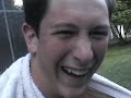 Balding