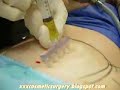 Cosmetic Treatment