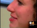 Don't get pregnant while you're on Accutane therapy  Isotretinoin Acne