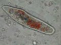 Paramecium eating pigmented yeast