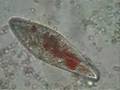 Paramecium eating pigmented yeast
