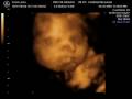Baby Emma - June 2008