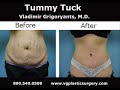 Los angeles plastic surgeon in Glendale Pasadena Los angeles plastic surgeon in Glendale Pasadena