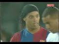Resposta ao RG - O que voce faz quando todo mundo te olha Resposta ao RG - O que voce faz quando todo mundo te olha