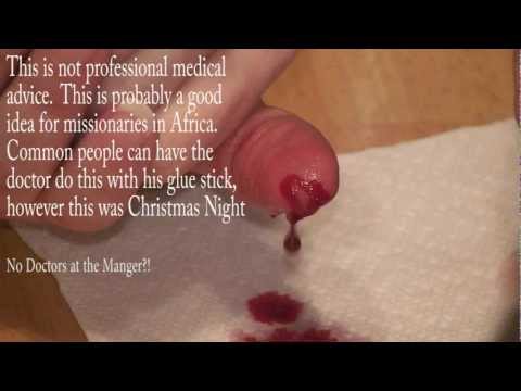 how to stop knife cut finger bleed