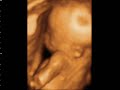 19 semanas 19 semanas