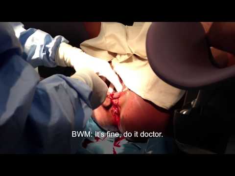 how to care episiotomy