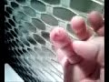 My Amputated Fingertip, One Month Later
