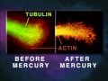 Neuro-Toxin - Mercury Melts Your Brain