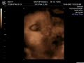 Milena 28 Semanas