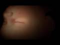 Life Before Birth (In The Womb)