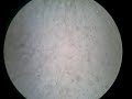 Sperm at 1000x Magnification Sperm at 1000x Magnification