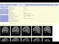 cloud based, pacs web portal to view dicom studies