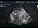 Welcome Baby Cuculich
