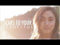 Alessia Cara | Scars To Your Beautiful (Alex G Cover)