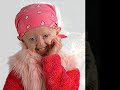 Progeria Infantiles
