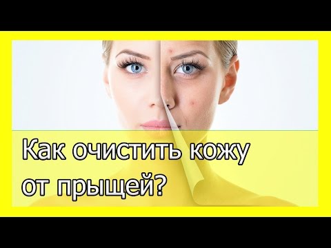 Очистка организма чтобы не было прыщей Очистка организма чтобы не было прыщей