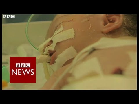 BABY - A premature baby has been delivered from a woman killed in a Israeli airstrike on Gaza. More than 800 people have been killed in Gaza since Israel launched its military offensive on 8 July...