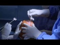 Oud keeper Piet Schrijvers krijg een nieuwe knie bij Bergman Clinics