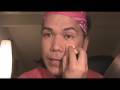 ACNE SCARS: Conceal & Soften