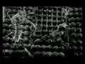 Sri / Serotonin Reuptake Inhibitor What you deserve video