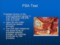 Radiation Therapy and Cancer Awareness Cancer Radiation Therapy