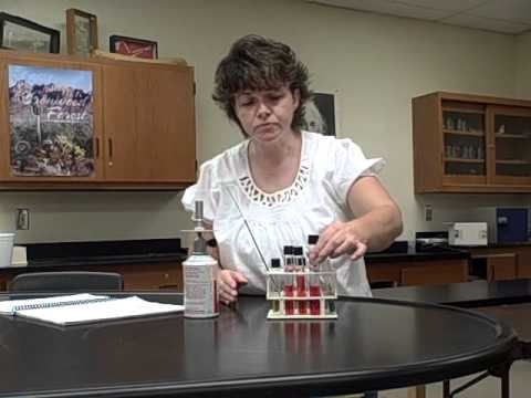 how to perform lactose fermentation test