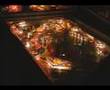 Amazing Spider-man pinball (longer version)