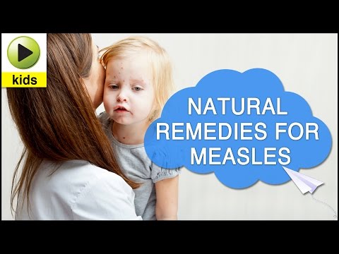 how to treat measles naturally