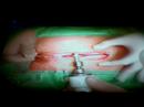 F�jdalom+�r�m