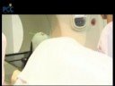 Revolutionary TomoTherapy for Cancer Revolutionary TomoTherapy for Cancer