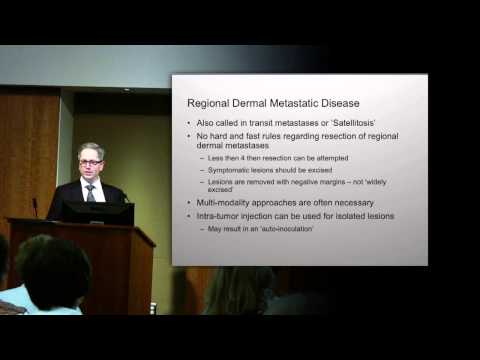 Treatment of Locally and Regionally Advanced Melanoma
