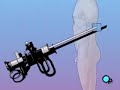 PreOp®  Patient Education: TURP Prostate Surgery