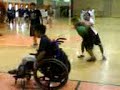 Down syndrome:&nbsp;Down Syndrome: Cool basket ball trick