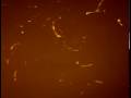Slugs and fruiting body formation