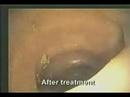 The ugly large intestine of diseases The ugly large intestine of diseases