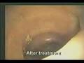 The ugly large intestine of diseases