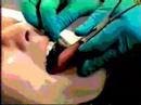 Tongue Piercing Tongue Piercing