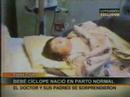 bebe ciclope en santa cruz bolivia