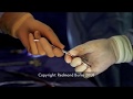 Tetralogy of Fallot Repair, TOF