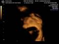 Baby Emma in... It\